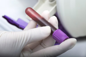 Blood Test